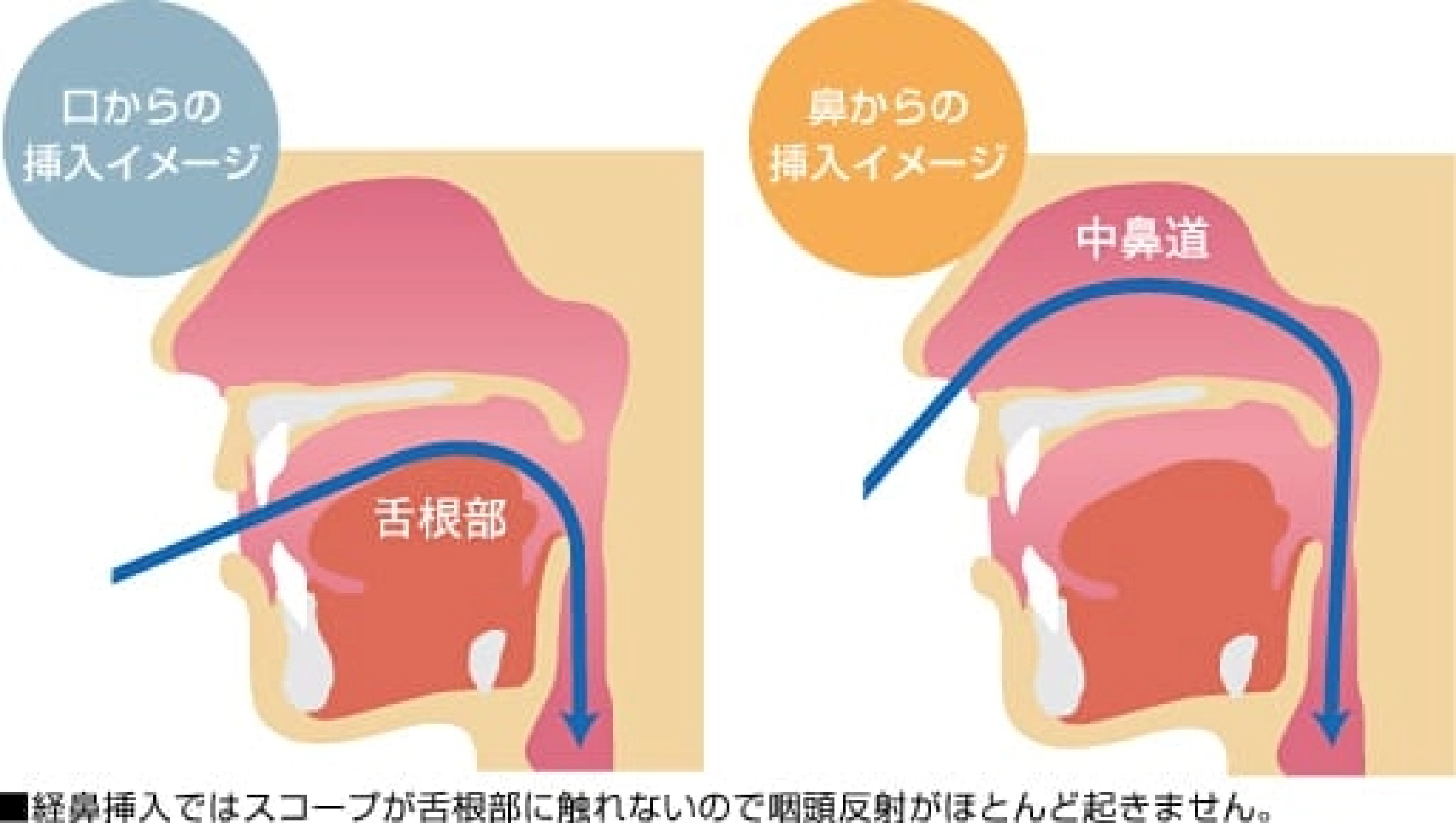 イメージ図